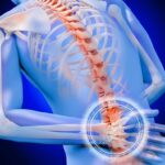 hernia-discal-ficha_64a76ec8_1280x720