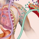 636775372186468717_diabetisysindromemetabolico