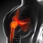 3d rendered anatomy illustration - painful shoulder