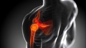 3d rendered anatomy illustration - painful shoulder