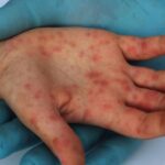 HMIKDCT4KJHAJOU6434D7N4LH4