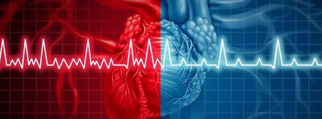 arritmia-cardiaca