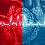 arritmia-cardiaca
