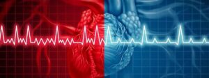 arritmia-cardiaca