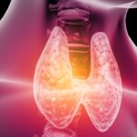 hipotiroidismo-ficha_2139808f_1280x720