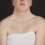 c0328637-turner-syndrome-science-photo-library-high_es