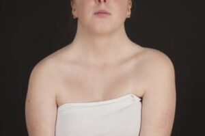 c0328637-turner-syndrome-science-photo-library-high_es